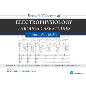 Essential Concepts of Electrophysiology Through Case Studies: Intracardiac EGMs: Intracardiac EGMs - Paperback