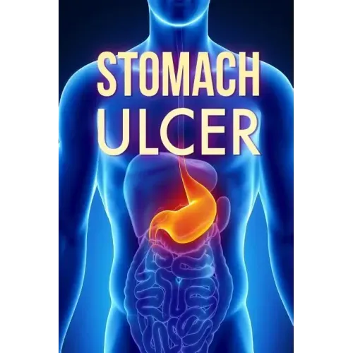 Stomach Ulcer: Treatment in 60 days!: Stomach Ulcer treatment