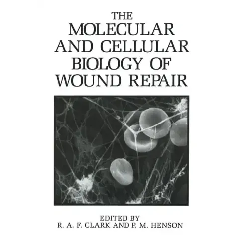 The Molecular and Cellular Biology of Wound Repair