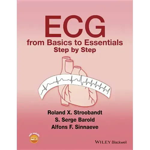 ECG from Basics to Essentials