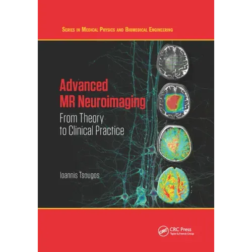 Advanced MR Neuroimaging: From Theory to Clinical Practice