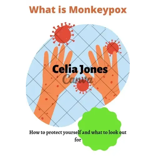 What Is Monkeypox: How to protect yourself and what to look out for. Guidelines for safety