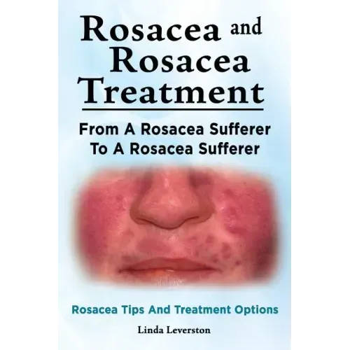 Rosacea and Rosacea Treatment. From A Rosacea Sufferer To A Rosacea Sufferer. Rosacea Tips And Treatment Options