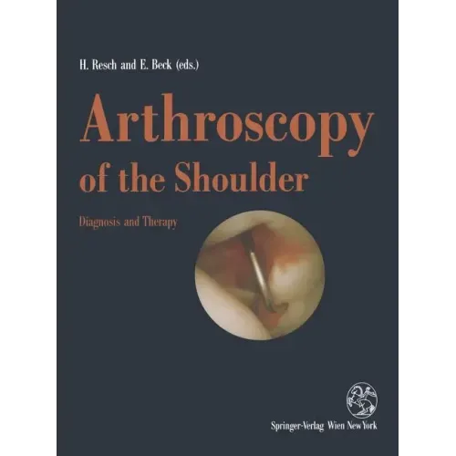Arthroscopy of the Shoulder: Diagnosis and Therapy