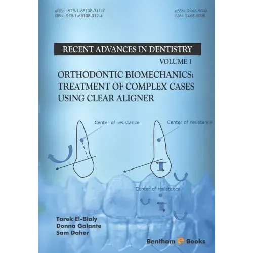Orthodontic Biomechanics: Treatment Of Complex Cases Using Clear Aligner
