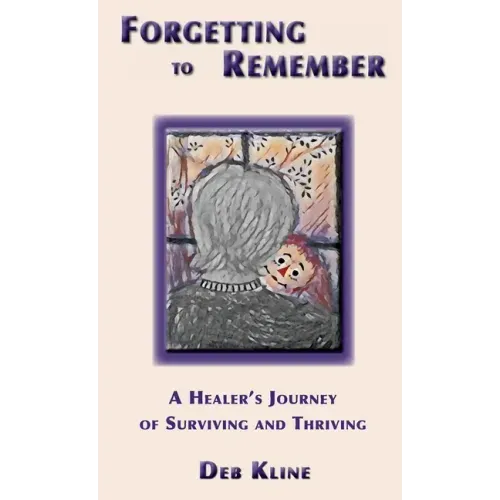 Forgetting to Remember