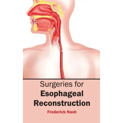 Surgeries for Esophageal Reconstruction