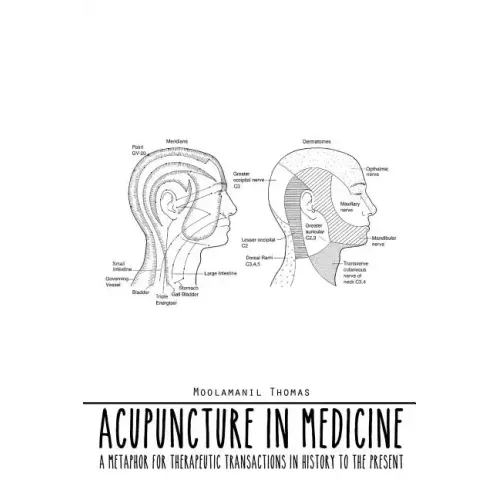 Acupuncture in Medicine: A Metaphor for Therapeutic Transactions in History to the Present