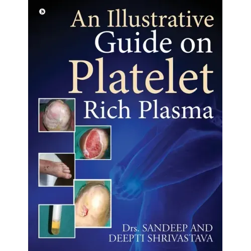 An Illustrative Guide on Platelet Rich Plasma