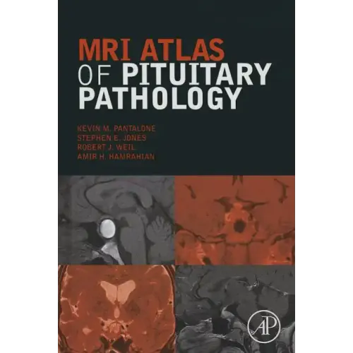 MRI Atlas of Pituitary Pathology