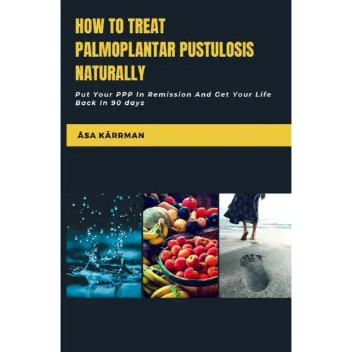 How To Treat Palmoplantar Pustulosis Naturally: Put Your PPP In Remission And Get Your Life Back In 90 Days