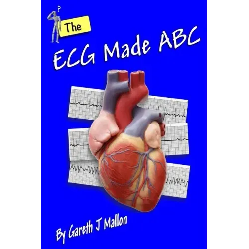 The ECG Made ABC