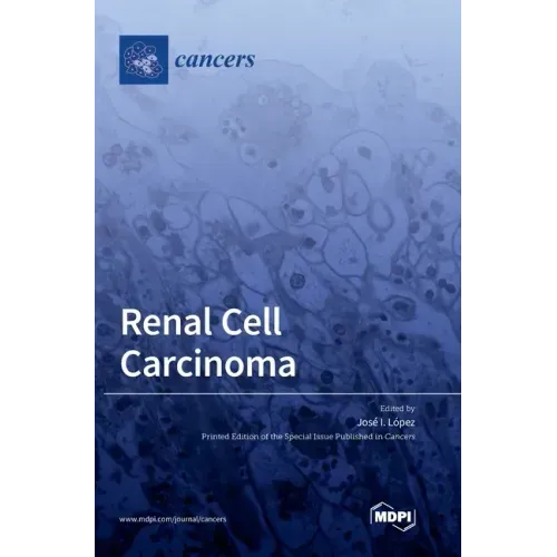 Renal Cell Carcinoma