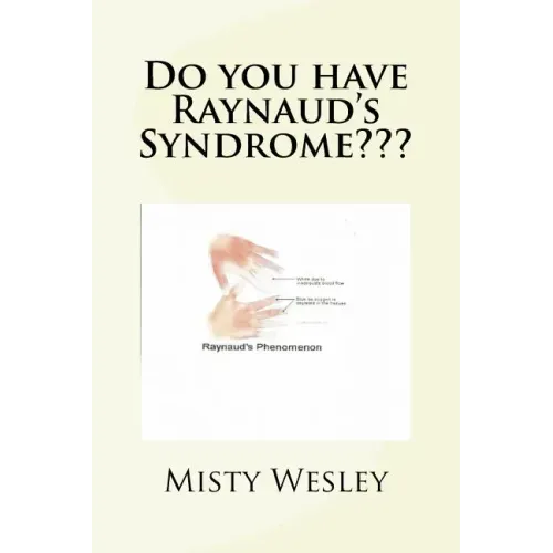 Do you have Raynaud's Syndrome