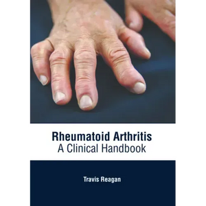 Rheumatoid Arthritis: A Clinical Handbook - Hardcover