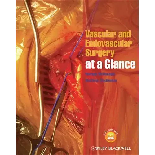 Vascular and Endovascular Surgery at a Glance