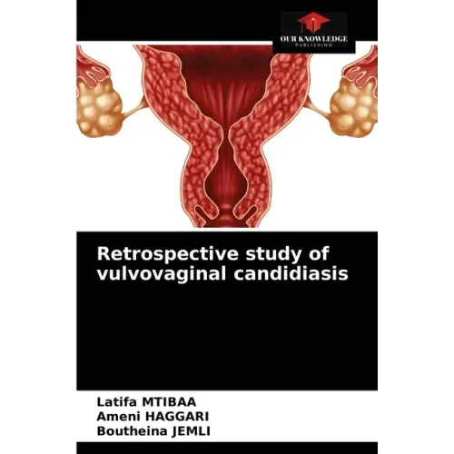 Retrospective study of vulvovaginal candidiasis