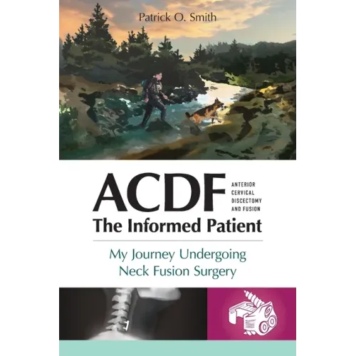 Acdf: The Informed Patient: My Journey Undergoing Neck Fusion Surgery