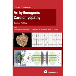 Current Concepts in Arrhythmogenic Cardiomyopathy, Second Edition - Hardcover