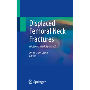 Displaced Femoral Neck Fractures: A Case-Based Approach - Paperback