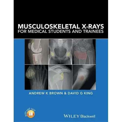 Musculoskeletal X-Rays for Medical Students and Trainees - Paperback