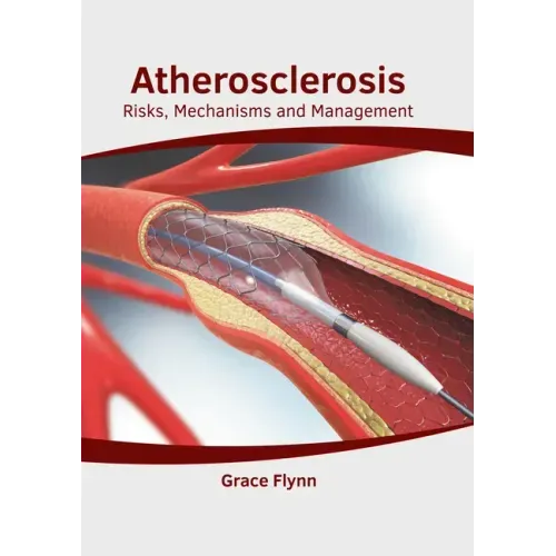 Atherosclerosis: Risks, Mechanisms and Management