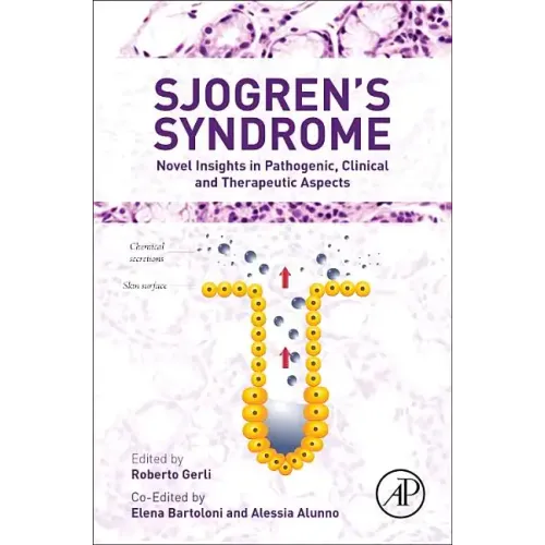 Sjogren's Syndrome: Novel Insights in Pathogenic, Clinical and Therapeutic Aspects
