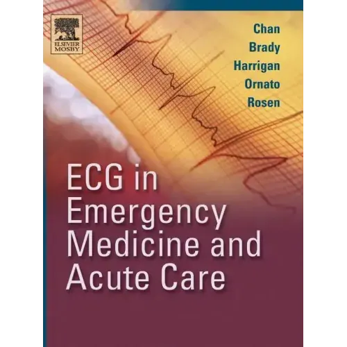 ECG in Emergency Medicine and Acute Care