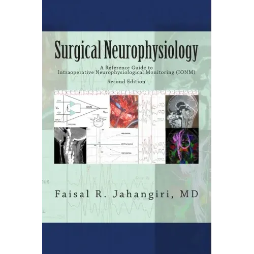 Surgical Neurophysiology - 2nd Edition: A Reference Guide to Intraoperative Neurophysiological Monitoring