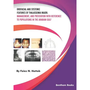 Orofacial and Systemic Features of Thalassemia Major: Management, and Prevention with Reference to Populations in the Arabian Gulf - Paperback