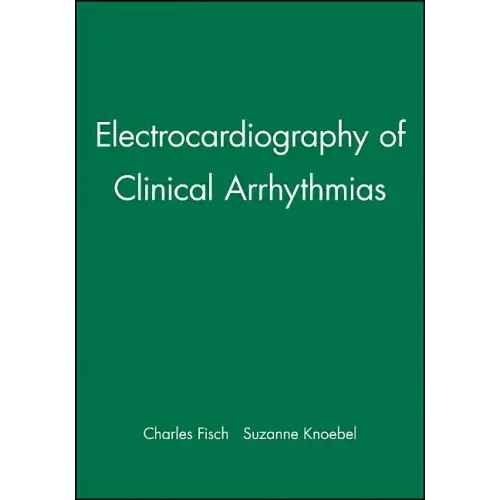 Electrocardiography of Clinical Arrhythmias
