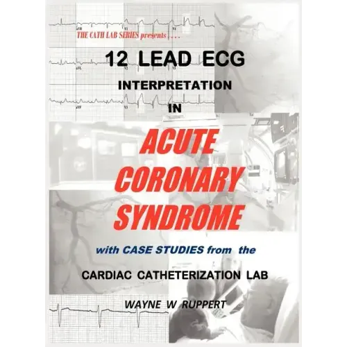 12 Lead ECG Interpretation in Acute Coronary Syndrome with Case Studies from the Cardiac Catheterization Lab