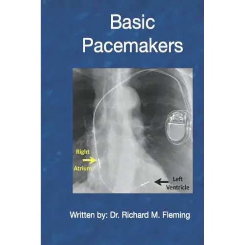 Basic Pacemakers