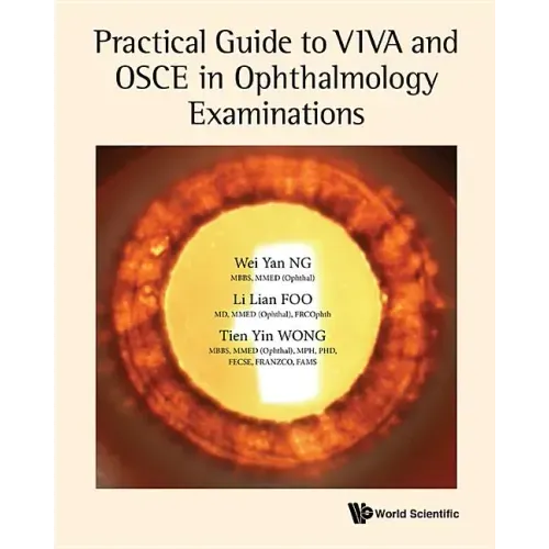 Practical Guide to Viva and OSCE in Ophthalmology Examinations