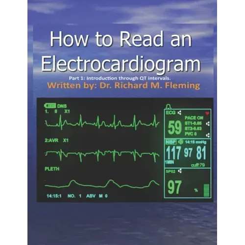 How to Read an Electrocardiogram.