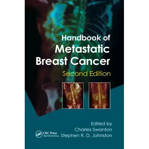 Handbook of Metastatic Breast Cancer
