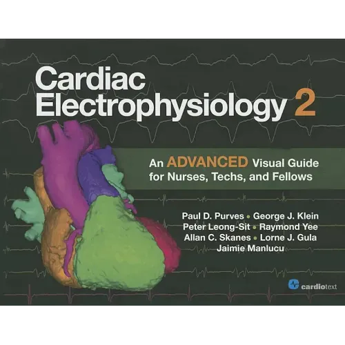 Cardiac Electrophysiology 2: An Advanced Visual Guide for Nurses, Techs, and Fellows