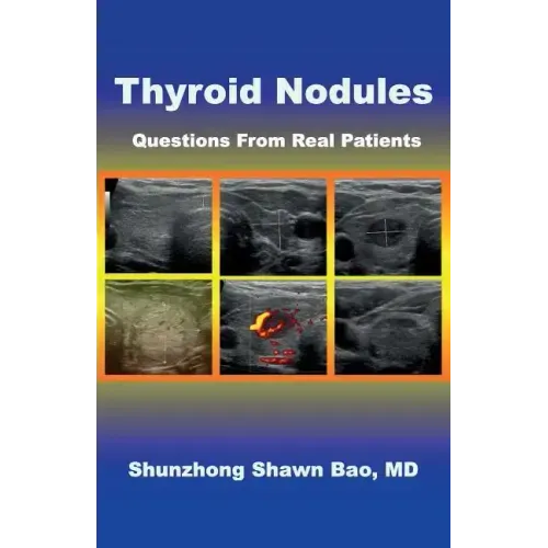 Thyroid Nodules: Questions From Real Patients