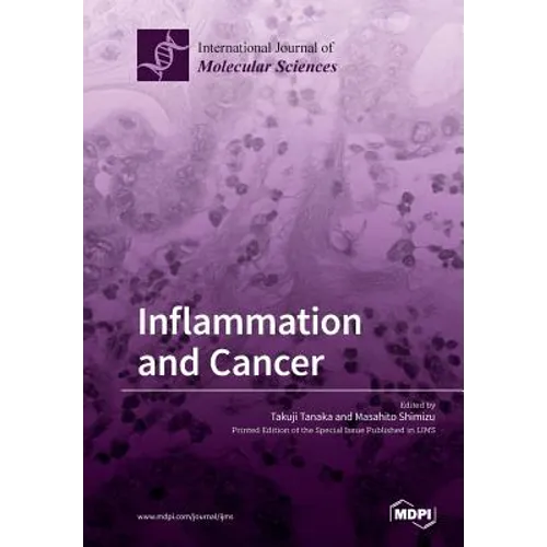 Inflammation and Cancer