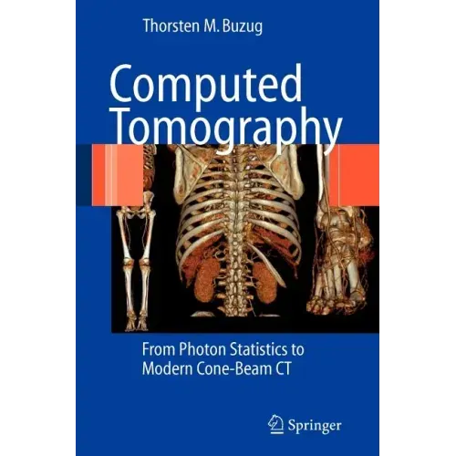 Computed Tomography: From Photon Statistics to Modern Cone-Beam CT