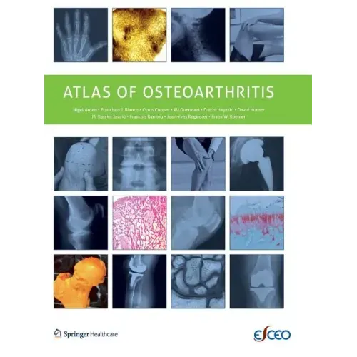 Atlas of Osteoarthritis