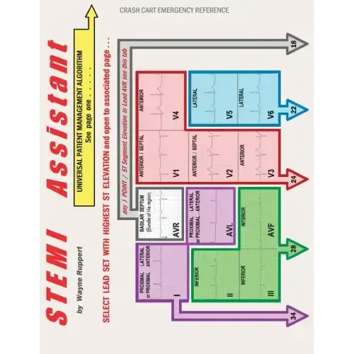 STEMI Assistant