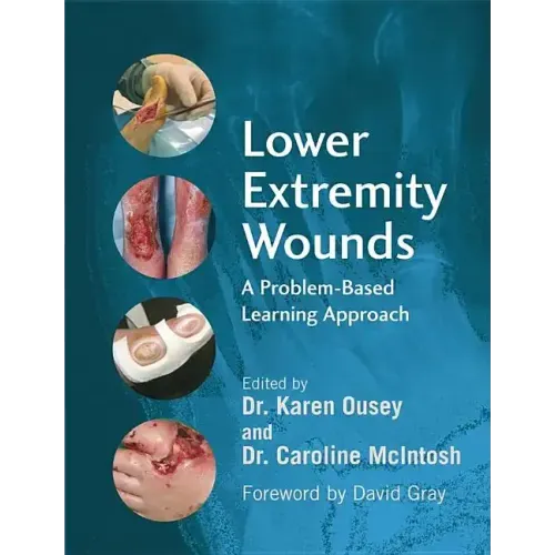 Lower Extremity Wounds: A Problem-Based Approach