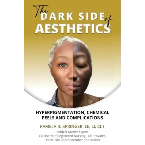 The Dark Side of Aesthetics: Hyperpigmentation, Chemical Peels, and Complications
