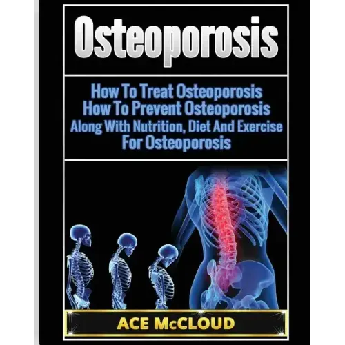 Osteoporosis: How To Treat Osteoporosis: How To Prevent Osteoporosis: Along With Nutrition, Diet And Exercise For Osteoporosis