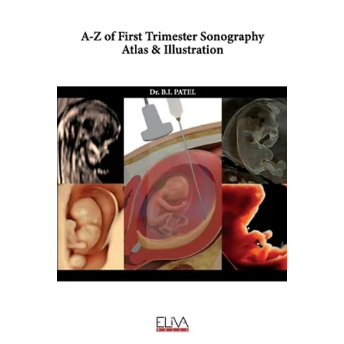 A-Z of First Trimester Sonography Atlas & Illustration