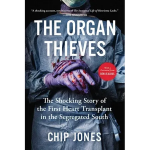 The Organ Thieves: The Shocking Story of the First Heart Transplant in the Segregated South - Paperback
