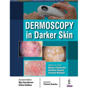 Dermoscopy in Darker Skin - Paperback