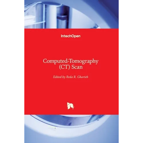 Computed-Tomography (CT) Scan