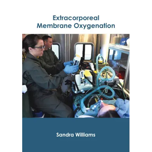 Extracorporeal Membrane Oxygenation
